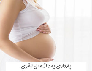 بارداری بعد از عمل لاغری