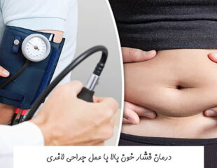 درمان فشار خون بالا با عمل جراحی لاغری